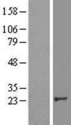 Western Blot: Crk Overexpression Lysate (Adult Normal) [NBL1-09484] Left-Empty vector transfected control cell lysate (HEK293 cell lysate); Right -Over-expression Lysate for Crk.