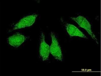 Immunocytochemistry/Immunofluorescence: CrkL Antibody [H00001399-B01P] - Analysis of purified antibody to CRKL on HeLa cell. (antibody concentration 10 ug/ml)