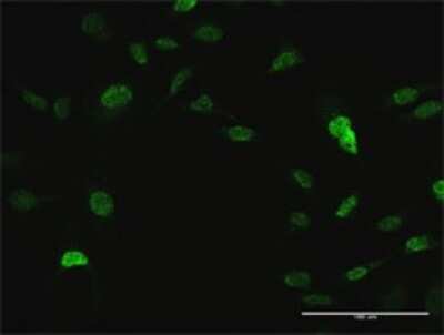 Immunocytochemistry/Immunofluorescence: CrkL Antibody [H00001399-D01P] - Analysis of antibody to CRKL on HeLa cell. Antibody concentration 10 ug/ml.