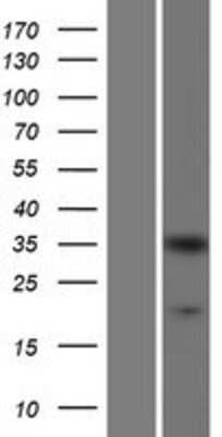 Western Blot: CrkL Overexpression Lysate (Adult Normal) [NBP2-07776] Left-Empty vector transfected control cell lysate (HEK293 cell lysate); Right -Over-expression Lysate for CrkL.