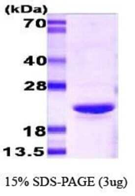 SDS-PAGE Recombinant Mouse AlphaB Crystallin/CRYAB Protein