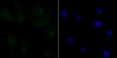 Immunocytochemistry/Immunofluorescence: CtBP1 Antibody (JG39-73) [NBP2-75453] - Staining CtBP1 in A549 cells (green). The nuclear counter stain is DAPI (blue). Cells were fixed in paraformaldehyde, permeabilised with 0.25% Triton X100/PBS.