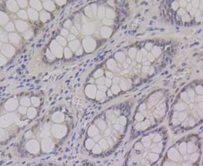 Immunohistochemistry-Paraffin: CtBP1 Antibody (JG39-73) [NBP2-75453] - Analysis of paraffin-embedded human colon tissue using anti-CtBP1 antibody. Counter stained with hematoxylin.
