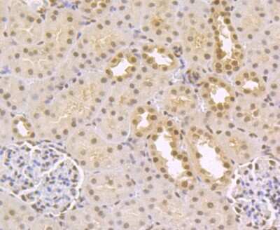 Immunohistochemistry-Paraffin: CtBP1 Antibody (JG39-73) [NBP2-75453] - Analysis of paraffin-embedded rat kidney tissue using anti-CtBP1 antibody. Counter stained with hematoxylin.