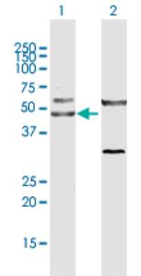 Western Blot: CtBP1 Antibody [H00001487-D01P] - Analysis of CTBP1 expression in transfected 293T cell line by CTBP1 polyclonal antibody.Lane 1: CTBP1 transfected lysate(46.40 KDa).Lane 2: Non-transfected lysate.