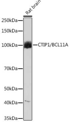 Western Blot: Ctip1 Antibody (3M8M3) [NBP3-16790] - Western blot analysis of extracts of Rat brain, using Ctip1 Rabbit mAb (NBP3-16790) at 1:1000 dilution. Secondary antibody: HRP Goat Anti-Rabbit IgG (H+L) at 1:10000 dilution. Lysates/proteins: 25ug per lane. Blocking buffer: 3% nonfat dry milk in TBST. Detection: ECL Basic Kit. Exposure time: 60s.