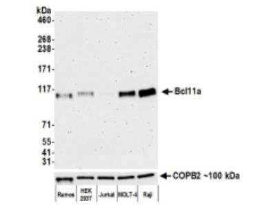 Western Blot: Ctip1 Antibody (BLR073G) [NBP2-78710] - Whole cell lysate (50 ug) from Ramos, HEK293T, Jurkat, MOLT-4, U2OS, and Raji cells prepared using NETN lysis buffer. Antibody: Rabbit anti-Bcl11a recombinantmonoclonal antibody [BLR073G] used at 1:1000. Secondary: HRP-conjugated goat anti-rabbit IgG. Chemiluminescence with an exposure time of 3 minutes.