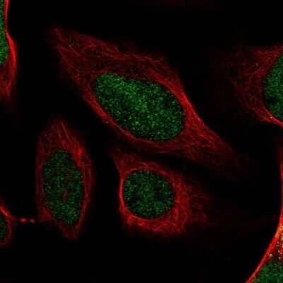 Immunocytochemistry/Immunofluorescence: Ctip1 Antibody [NBP2-38141] - Immunofluorescent staining of human cell line U-2 OS shows localization to nucleoplasm.