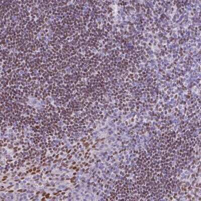 Immunohistochemistry: Ctip1 Antibody [NBP2-38141] - Staining of human tonsil shows moderate nuclear positivity in leukocytes.