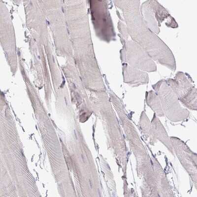 Immunohistochemistry-Paraffin: Ctip1 Antibody [NBP2-38141] - Staining of human skeletal muscle shows low expression as expected.