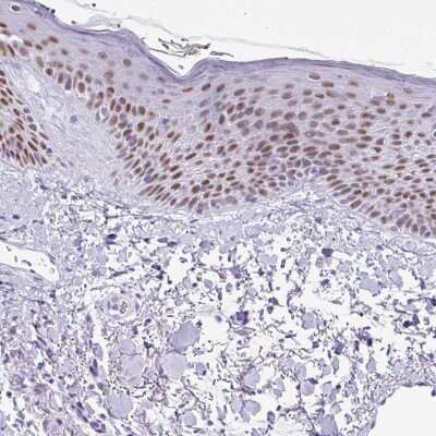 Immunohistochemistry-Paraffin: Ctip1 Antibody [NBP2-38141] - Staining of human skin shows high expression.