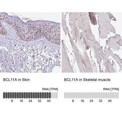 Immunohistochemistry-Paraffin: Ctip1 Antibody [NBP2-38141] - Staining in human skin and skeletal muscle tissues using anti-BCL11A antibody. Corresponding BCL11A RNA-seq data are presented for the same tissues.