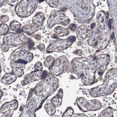 Immunohistochemistry-Paraffin: Ctip1 Antibody [NBP3-17030] - Staining of human placenta shows low expression as expected.