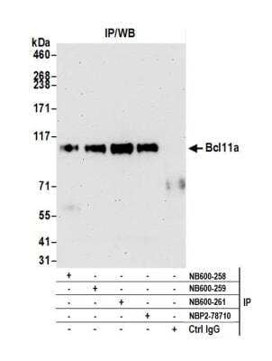 <b>Independent Antibodies Validation. </b>Immunoprecipitation: Ctip1 Antibody [NB600-258] - Detection of human Ctip1 by western blot of immunoprecipitates. Samples: Whole cell lysate (1.0 mg per IP reaction; 20% of IP loaded) from Ramos cells. Antibodies: Affinity purified rabbit Ctip1 Antibody NB600-258 used for IP at 6 ul/mg lysate. Ctip1 was also immunoprecipitated by rabbit anti-Ctip1 antibodies (NB600-259, NB600-261) and rabbit anti-Ctip1 recombinant monoclonal antibody [BLR073G] (NBP2-78710). For blotting immunoprecipitated Ctip1, NBP2-78710 was used at 1:1000. Chemiluminescence with an exposure time of 75 seconds.