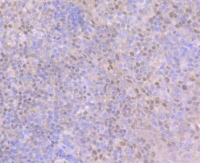 Immunohistochemistry-Paraffin: Ctip1 Antibody (JB35-68) [NBP2-75455] - Analysis of paraffin-embedded human tonsil tissue using anti-Ctip1 antibody. Counter stained with hematoxylin.