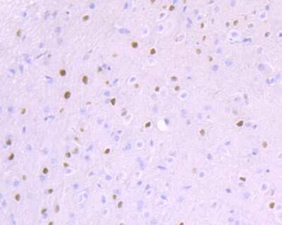 Immunohistochemistry-Paraffin: Ctip1 Antibody (JB35-68) [NBP2-75455] - Analysis of paraffin-embedded mouse cerebellum tissue using anti-Ctip1 antibody. Counter stained with hematoxylin.