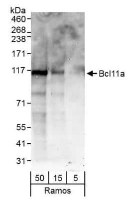 Western Blot: Ctip1 Antibody [NB600-258] - Detection of Human Ctip1 (Bcl11a) by western blot. Samples: Whole cell lysate (5, 15 and 50 ug) from Ramos cells. Antibodies: Affinity purified rabbit Ctip1 Antibody NB600-258 used at 0.4 ug/ml. Detection: Chemiluminescence with exposure times of 3 minutes.