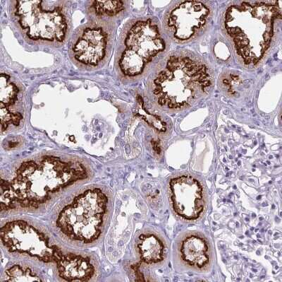 Immunohistochemistry-Paraffin: Cubilin Antibody [NBP2-62596] - Staining of human kidney shows strong positivity in apical membrane in cells in proximal tubules.