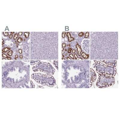 <b>Independent Antibodies Validation and Orthogonal Strategies Validation.</b>Immunohistochemistry-Paraffin: Cubilin Antibody [NBP2-62596] - Staining of human kidney, liver, prostate and small intestine using Anti-CUBN antibody NBP2-62596 (A) shows similar protein distribution across tissues to independent antibody NBP2-62611 (B).