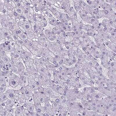 Immunohistochemistry-Paraffin: Cubilin Antibody [NBP2-62596] - Staining of human liver shows no positivity in hepatocytes as expected.