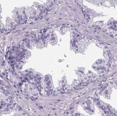 Immunohistochemistry-Paraffin: Cubilin Antibody [NBP2-62596] - Staining of human prostate shows no positivity in glandular cells as expected.