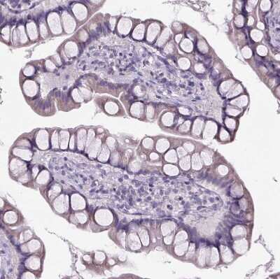 Immunohistochemistry-Paraffin: Cubilin Antibody [NBP2-62596] - Staining of human small intestine shows weak cytoplasmic positivity in glandular cells.