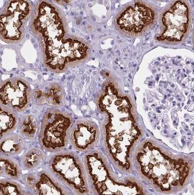 Immunohistochemistry-Paraffin: Cubilin Antibody [NBP2-62611] - Staining of human kidney shows strong positivity in apical membrane in cells in proximal tubules.