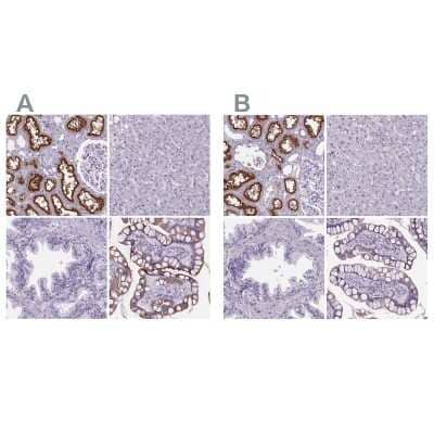 <b>Independent Antibodies Validation and Orthogonal Strategies Validation.</b>Immunohistochemistry-Paraffin: Cubilin Antibody [NBP2-62611] - Staining of human kidney, liver, prostate and small intestine using Anti-CUBN antibody NBP2-62611 (A) shows similar protein distribution across tissues to independent antibody NBP2-62596 (B).