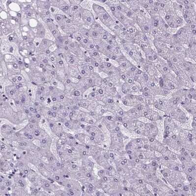 Immunohistochemistry-Paraffin: Cubilin Antibody [NBP2-62611] - Staining of human liver shows no positivity in hepatocytes as expected.