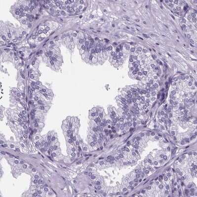 Immunohistochemistry-Paraffin: Cubilin Antibody [NBP2-62611] - Staining of human prostate shows no positivity in glandular cells as expected.