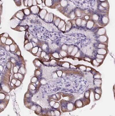 Immunohistochemistry-Paraffin: Cubilin Antibody [NBP2-62611] - Staining of human small intestine shows weak to moderate cytoplasmic positivity in glandular cells.