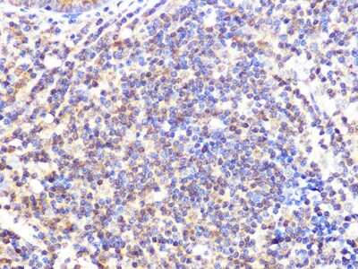 Immunohistochemistry-Paraffin: Cullin 2 Antibody (4Y7E4) [NBP3-16546] - Immunohistochemistry of paraffin-embedded human appendix using Cullin 2 Rabbit mAb (NBP3-16546) at dilution of 1:100 (40x lens).Perform microwave antigen retrieval with 10 mM PBS buffer pH 7.2 before commencing with IHC staining protocol.