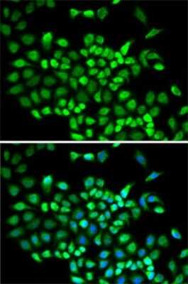 Immunocytochemistry/Immunofluorescence: Cullin 2 Antibody [NBP2-92651] - Analysis of A-549 cells using Cullin 2 . Blue: DAPI for nuclear staining.