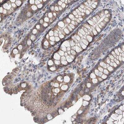 Immunohistochemistry: Cullin 2 Antibody [NBP1-87544] - Staining of human colon shows moderate cytoplasmic positivity in glandular cells.