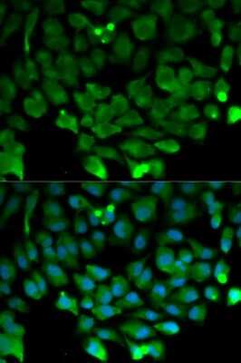 Immunocytochemistry/Immunofluorescence: Cullin 3 Antibody [NBP2-92848] - Analysis of HeLa cells using Cullin 3 . Blue: DAPI for nuclear staining.