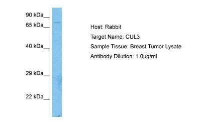 Western Blot: Cullin 3 Antibody [NBP2-88797] - Host: Rabbit. Target Name: CUL3. Sample Type: Breast Tumor. Antibody Dilution: 1.0ug/ml