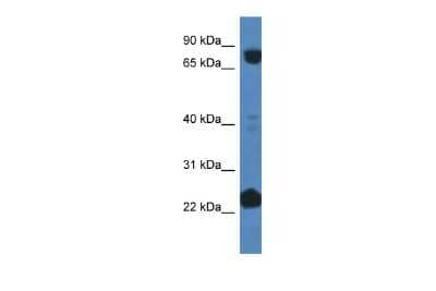 Western Blot: Cullin 3 Antibody [NBP2-88798] - WB Suggested Anti-CUL3 Antibody Titration: 1 ug/ml. Positive Control: Fetal liver cell lysate