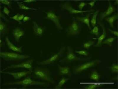 Immunocytochemistry/Immunofluorescence: Cullin 4a Antibody (3H3) [H00008451-M01] - Analysis of monoclonal antibody to CUL4A on HeLa cell . Antibody concentration 20 ug/ml.