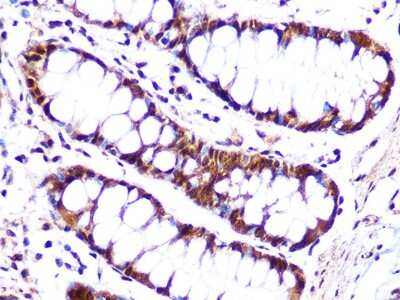 Immunohistochemistry-Paraffin: Cullin 4a Antibody (5P4M1) [NBP3-16539] - Immunohistochemistry of paraffin-embedded human colon using Cullin 4a Rabbit mAb (NBP3-16539) at dilution of 1:100 (40x lens).Perform microwave antigen retrieval with 10 mM Tris/EDTA buffer pH 9.0 before commencing with IHC staining protocol.