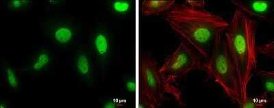 Immunocytochemistry/Immunofluorescence: Cullin 4a Antibody (GT2435) [NBP3-13595] - Cullin 4a antibody [GT2435] detects Cullin 4a protein at nucleus by immunofluorescent analysis. Sample: HeLa cells were fixed in 4% paraformaldehyde at RT for 15 min. Green: Cullin 4a protein stained by Cullin 4a antibody [GT2435] (NBP3-13595) diluted at 1:200. Red: Phalloidin, a cytoskeleton marker, diluted at 1:100. Scale bar = 10 um.