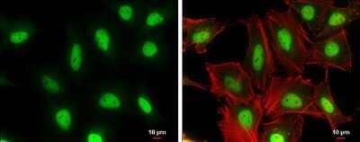 Immunocytochemistry/Immunofluorescence: Cullin 4a Antibody (GT885) [NBP3-13594] - Cullin 4a antibody [GT885] detects Cullin 4a protein at nucleus by immunofluorescent analysis. Sample: HeLa cells were fixed in 4% paraformaldehyde at RT for 15 min. Green: Cullin 4a protein stained by Cullin 4a antibody [GT885] (NBP3-13594) diluted at 1:200. Red: Phalloidin, a cytoskeleton marker, diluted at 1:100. Scale bar = 10 um.