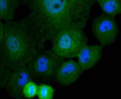 Immunocytochemistry/Immunofluorescence: Cullin 4a Antibody (JU07-33) [NBP2-75459] - Staining Cullin 4a in A431 cells (green). The nuclear counter stain is DAPI (blue). Cells were fixed in paraformaldehyde, permeabilised with 0.25% Triton X100/PBS.