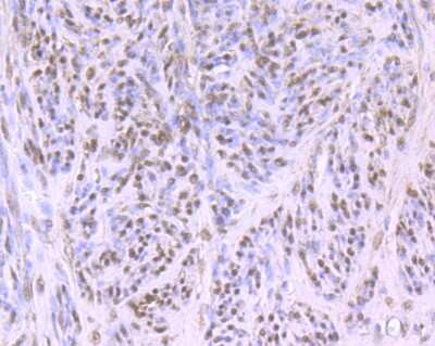 Immunohistochemistry-Paraffin: Cullin 4a Antibody (JU07-33) [NBP2-75459] - Analysis of paraffin-embedded human cervix tissue using anti-Cullin 4a antibody. Counter stained with hematoxylin.