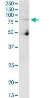 Western Blot: Cullin 4a Antibody [H00008451-B01P] - Analysis of CUL4A expression in human colon.