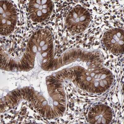 Immunohistochemistry-Paraffin: Cullin 5 Antibody [NBP1-86868] - Staining of human colon shows strong nuclear and cytoplasmic positivity in glandular cells.