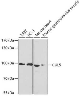 Western Blot: Cullin 5 Antibody [NBP2-92652] - Analysis of extracts of various cell lines, using Cullin 5 at 1:1000 dilution.Secondary antibody: HRP Goat Anti-Rabbit IgG (H+L) at 1:10000 dilution.Lysates/proteins: 25ug per lane.Blocking buffer: 3% nonfat dry milk in TBST.Detection: ECL Basic Kit .Exposure time: 90s.