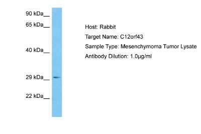 Western Blot: Custos Antibody [NBP2-84733] - Host: Rabbit. Target Name: C12ORF43. Sample Tissue: Human Mesenchymoma Tumor lysates. Antibody Dilution: 1ug/ml