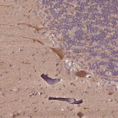 Immunohistochemistry-Paraffin CutA Antibody