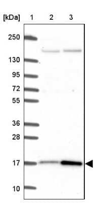 Western Blot CutA Antibody