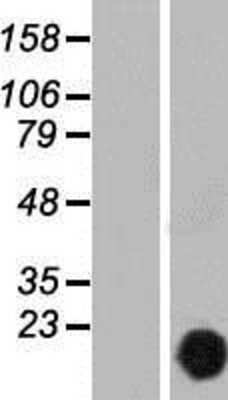Western Blot: CutA Overexpression Lysate (Adult Normal) [NBP2-08747] Left-Empty vector transfected control cell lysate (HEK293 cell lysate); Right -Over-expression Lysate for CutA.